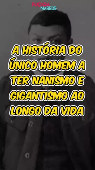 Conheça a história de Adam Rainer, a única pessoa ...| Kwai